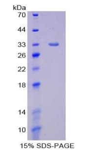 Rat LIPG / Endothelial Lipase Protein (Recombinant His-T7)