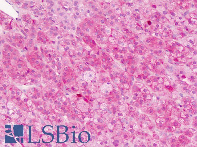 IHC-plus™ Polyclonal Rabbit anti-Human GNA12 Antibody (Ser67, IHC, WB)