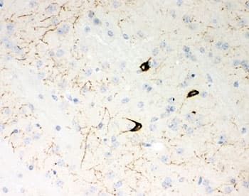 Polyclonal Rabbit anti-Human Neuropeptide Y / NPY Antibody (aa29-59, IHC)