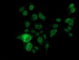 KLK8 / Kallikrein 8 Antibody (clone OTI4A5)