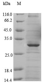 Human MFSD8 Protein (Recombinant GST-6His, N-terminus)