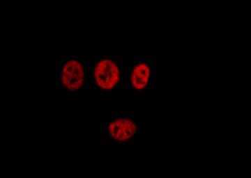 Treacle / TCOF1 Antibody