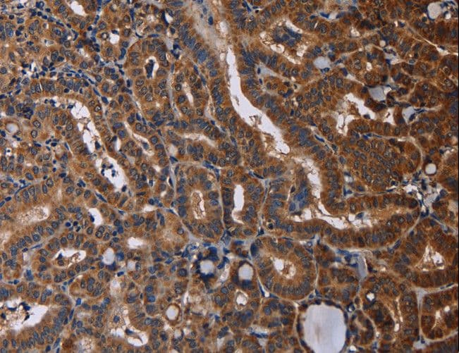 RTN4R Antibody