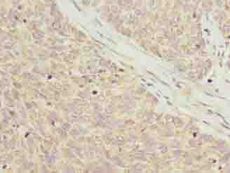 C8orf22 Antibody