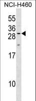 Polyclonal Rabbit anti-Human MPZL2 Antibody (aa67-94, WB)