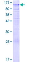 Human ZNF526 Protein (Recombinant GST)
