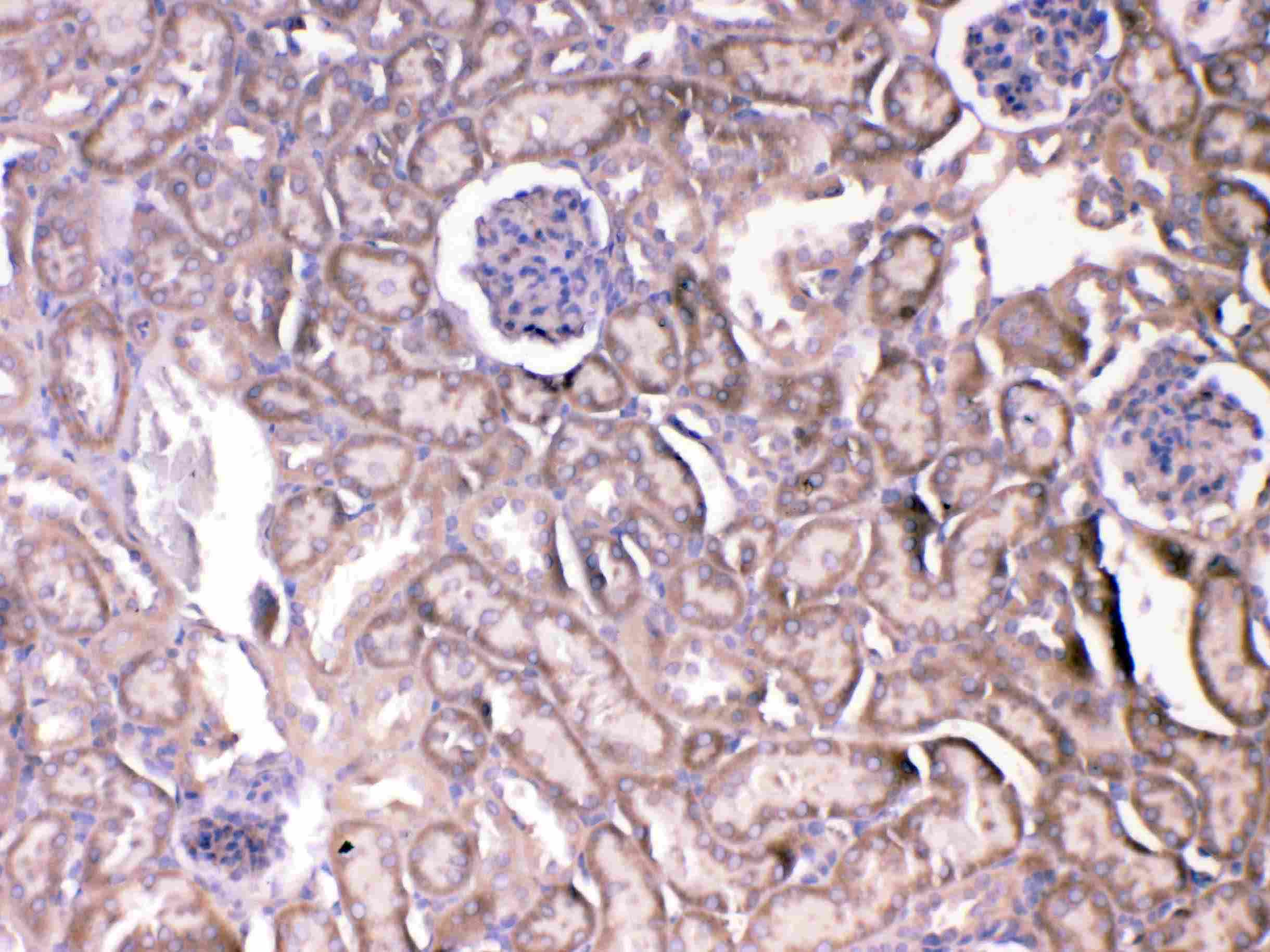 KDR / VEGFR2 / FLK1 Antibody