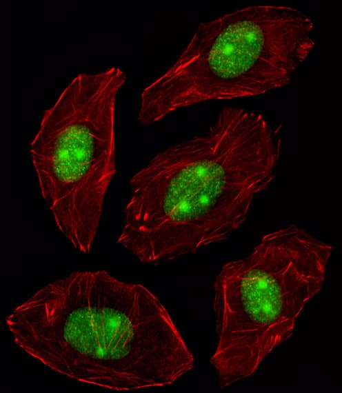 NPM1 / NPM / Nucleophosmin Antibody (aa198-226)