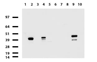 KRT19 / CK19 / Cytokeratin 19 Antibody (aa240-390, clone UMAB3, Carrier-free)