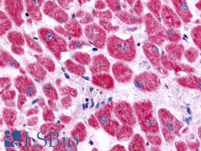 PathPlus™ EDNRA / Endothelin A Receptor Antibody (Extracellular Domain)