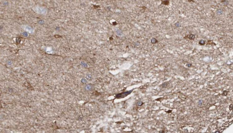 SGCB / SGC / Sarcoglycan Beta Antibody