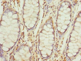 Polyclonal Rabbit anti-Human RP2 Antibody (IHC, IF)