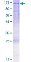 Human EPHA2 / EPH Receptor A2 Protein (Recombinant GST)