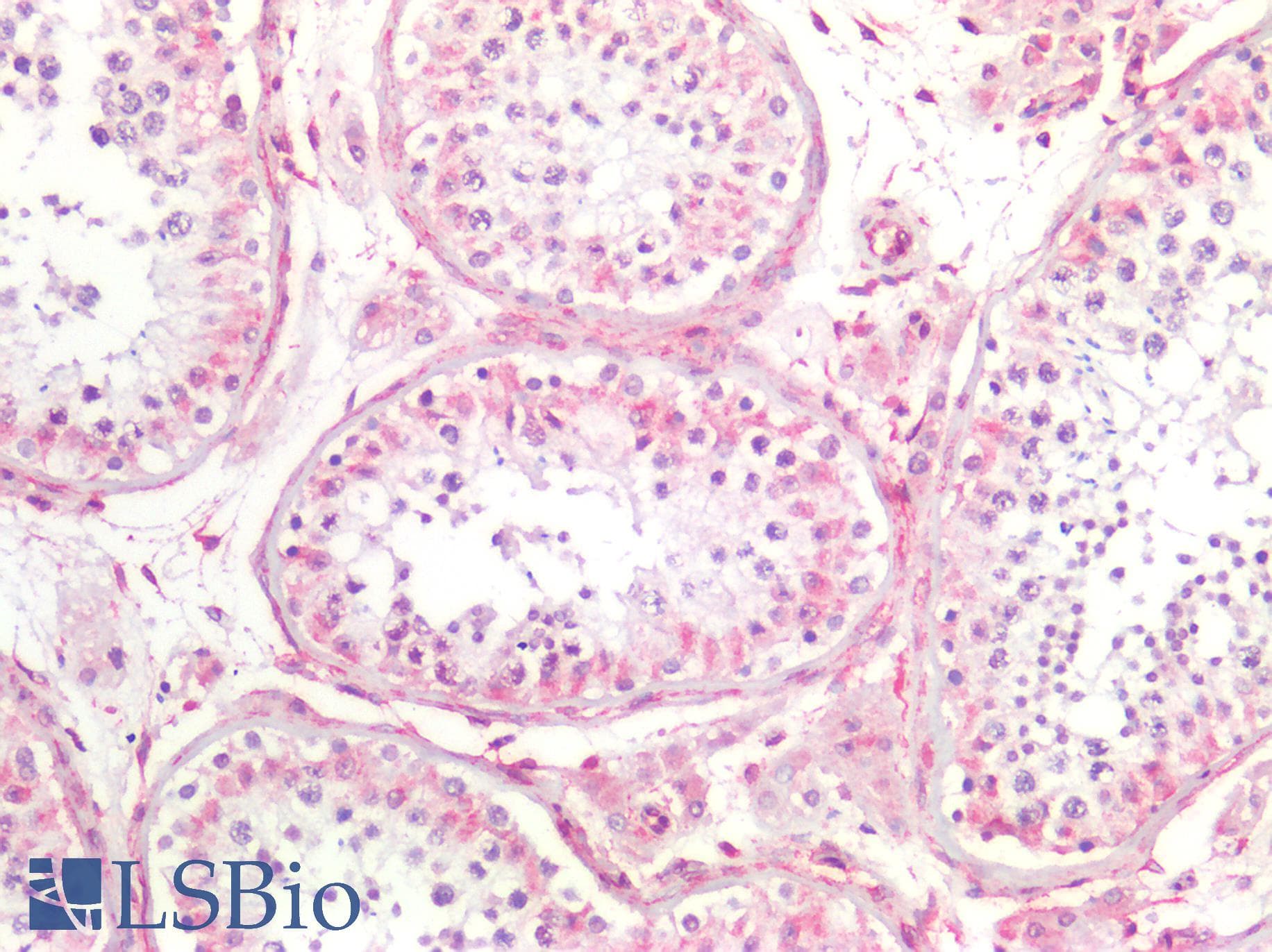 PathPlus™ Vimentin Antibody (clone RV202)