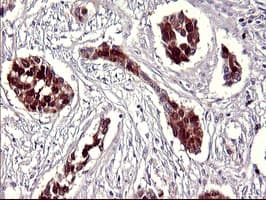 SERPINB3 Antibody (clone OTI1F10)