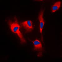 CALM1 / Calmodulin Antibody (Internal)