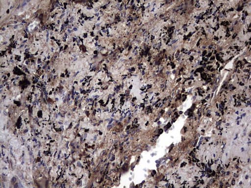 IL1RN Antibody (clone OTI2B1)