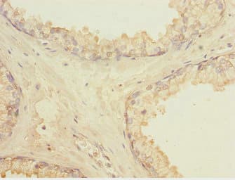 LMO4 Antibody
