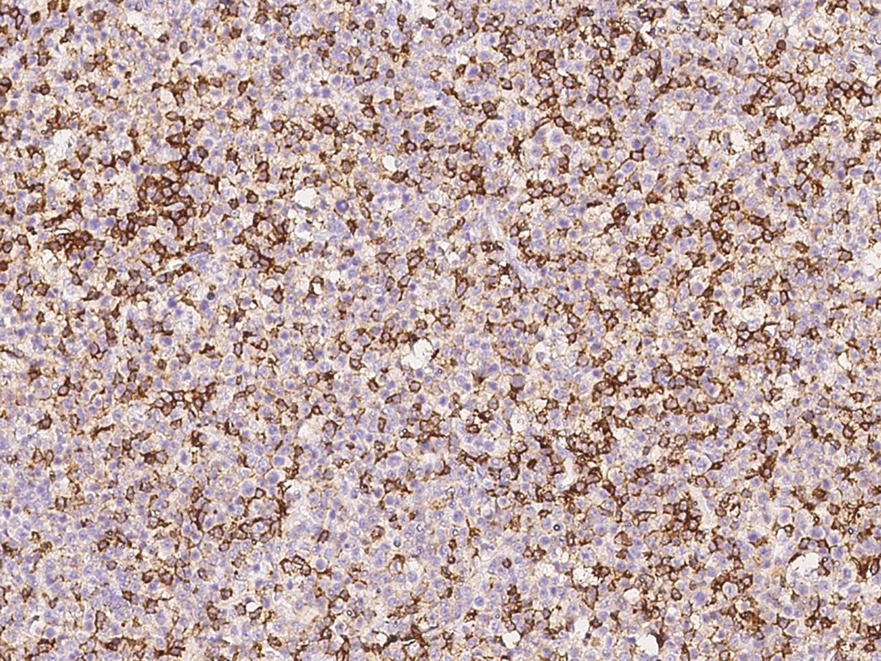 Monoclonal Mouse anti-Human CD45 / LCA Antibody (clone 15, Preservative Free, IHC, WB)