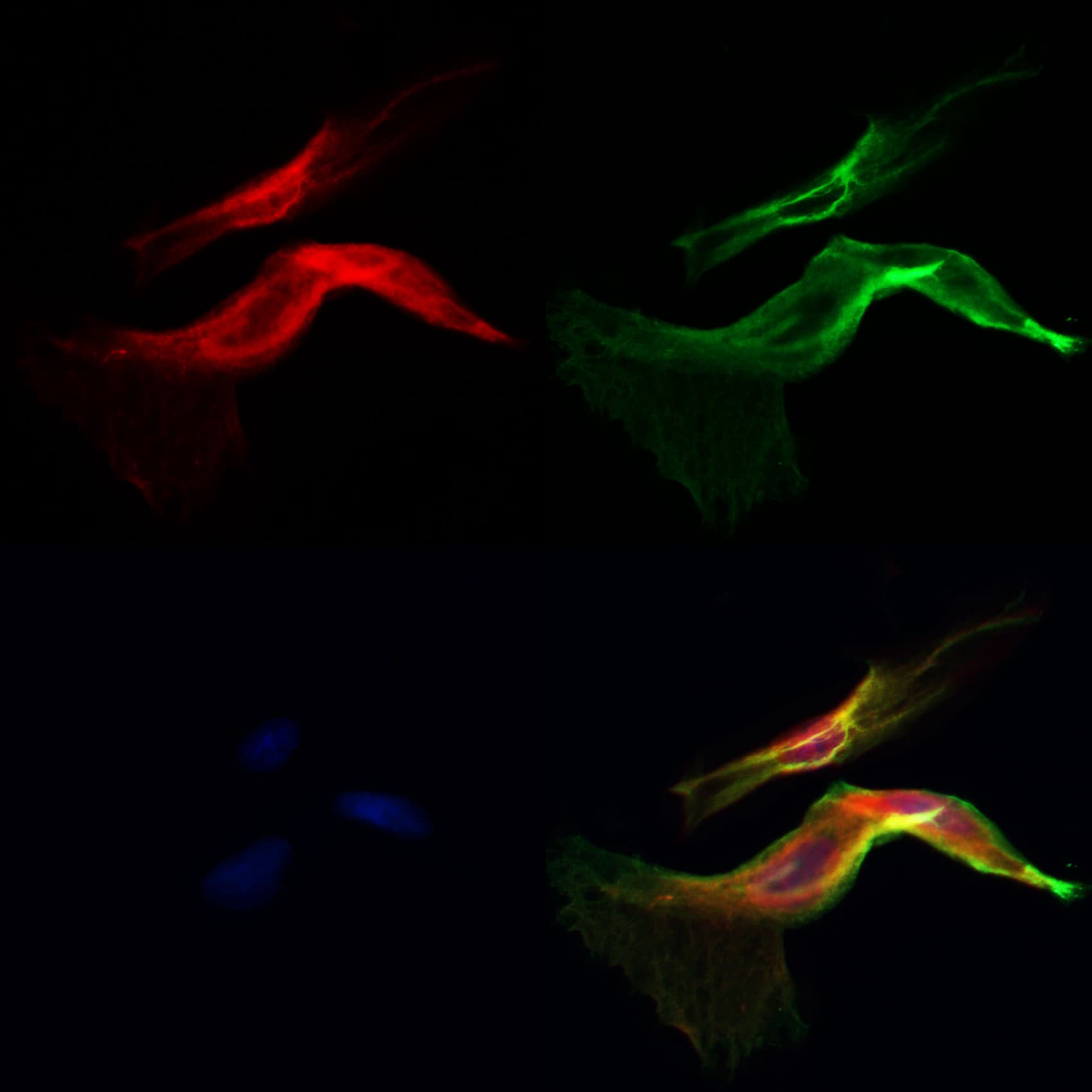 Polyclonal Rabbit anti-Human CSPG4 / NG2 Antibody (IHC, IF, WB)