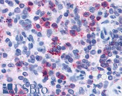 IHC-plus™ Polyclonal Rabbit anti-Human P2RY4 / P2Y4 Antibody (Cytoplasmic Domain, IHC)