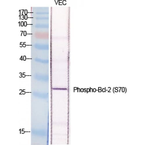 Polyclonal Rabbit anti-Human BCL2 / Bcl-2 Antibody (10-90 aa, IHC, WB)