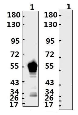 SARS-CoV-2 Nucleoprotein Antibody