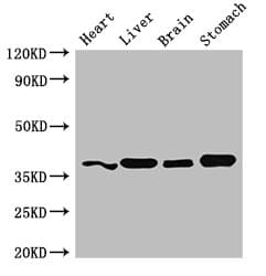 Polyclonal Rabbit anti-Human YIPF3 Antibody (IHC, IF, WB)