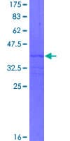 Human IL4 Protein (Recombinant GST, N-terminus)