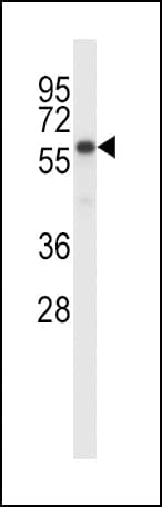 IHC-plus™ BIRC2 / cIAP1 Antibody (aa216-244)