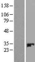 CMBL Protein (Over-Expression Lysate Myc-DDK (Flag))