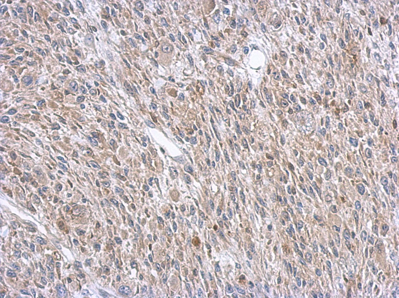 ASL / Argininosuccinate Lyase Antibody (aa13-261)