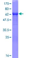 Human TALDO1 / Transaldolase 1 Protein (Recombinant GST)