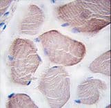 PIK3C3 / VPS34 Antibody (aa770-801)