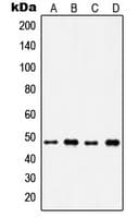IP6K2 Antibody (Internal)