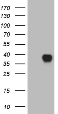 CD79B / CD79 Beta Antibody (clone OTI2H8)