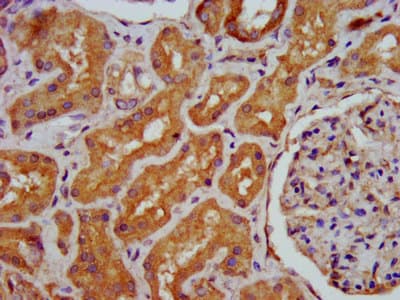 Polyclonal Rabbit anti-Human HPS6 Antibody (IHC, IF)