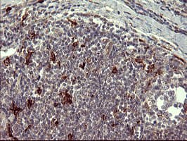 MMP13 Antibody (aa104-471, clone OTI3H3)
