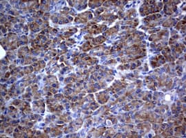 Monoclonal Mouse anti-Human PIK3C2A Antibody (clone OTI2D9, aa230-560, IHC, WB)