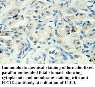 Polyclonal Rabbit anti-Human NEDD4 Antibody (aa634-878, IHC, WB)
