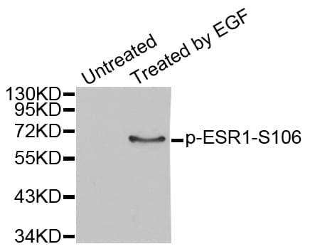Polyclonal Rabbit anti-Human ER Alpha / Estrogen Receptor Antibody (phospho-Ser106, IHC, IF, WB)