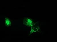 CTNNB1 / Beta Catenin Antibody (clone OTI1E10, Carrier-free)