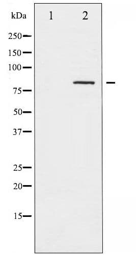 CALD1 / Caldesmon Antibody (phospho-Ser789)