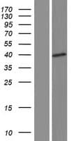 SAMD4A Protein (Over-Expression Lysate Myc-DDK (Flag))