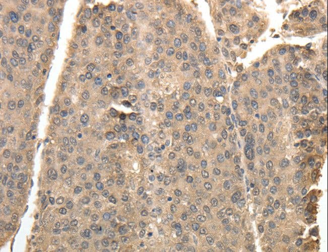 TXN / Thioredoxin / TRX Antibody