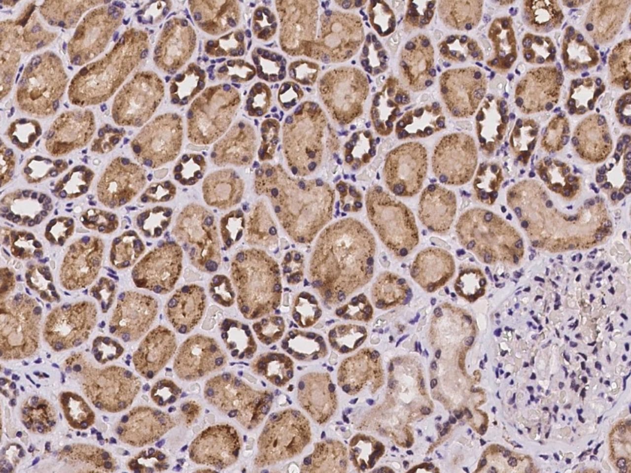 SLC39A8 / ZIP8 Antibody