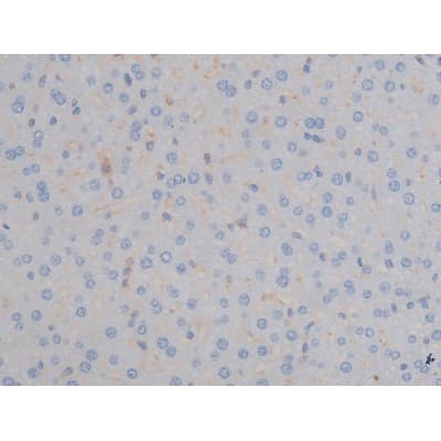 IGF1R / IGF1 Receptor Antibody (phospho-Tyr1161)
