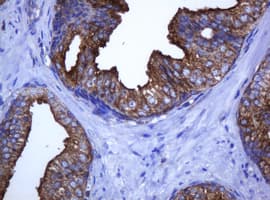 CATIP / C2orf62 Antibody (clone OTI2D9)