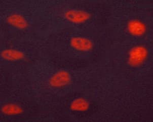 Polyclonal Rabbit anti-Human HNF4A / HNF4 Antibody (phospho-Ser313, IHC, IF, WB)