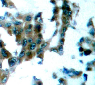 PRKCQ / PKC-Theta Antibody (phospho-Ser695)